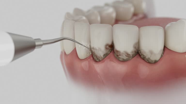 Reliable Dental contractor in Chestertown, MD by Dentist Open Now